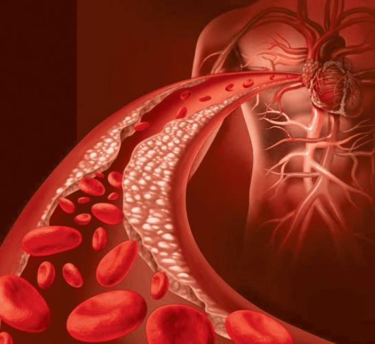 每天壓腿能減輕腳疼 特別是穿高跟鞋的女性！