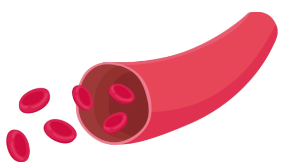 每天壓腿能減輕腳疼 特別是穿高跟鞋的女性！